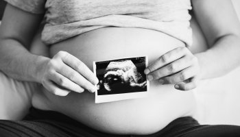 Έγκυος γυναίκα